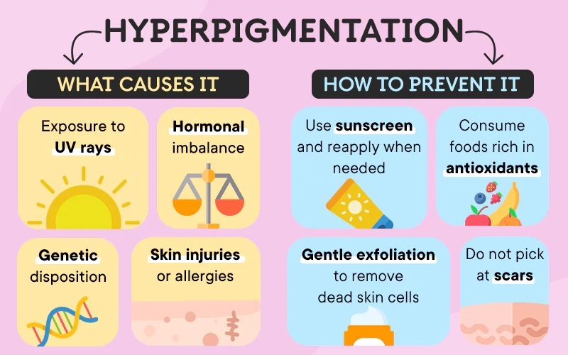 Causes of Hyperpigmentation and how to prevent it
